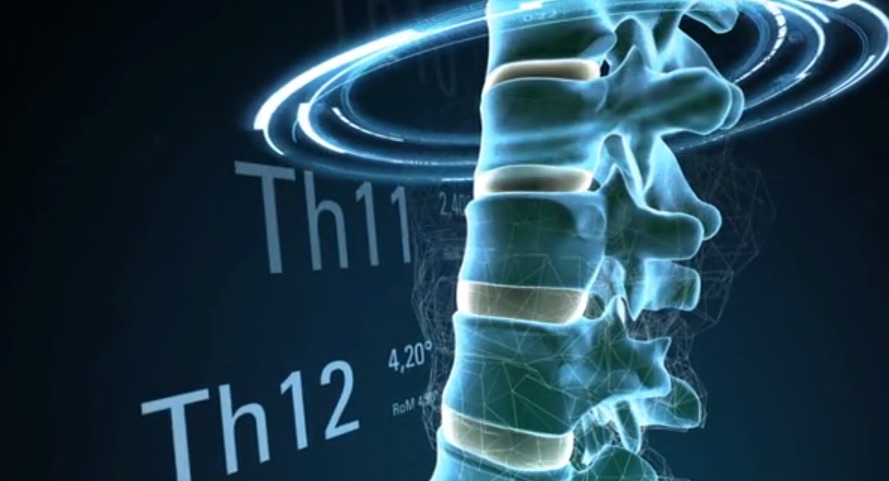 Spontech Interactive Spine by Design and Systems